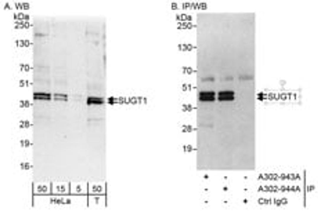 Detection of human SUGT1 by western blot and immunoprecipitation.