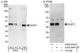 Detection of human SUGT1 by western blot and immunoprecipitation.