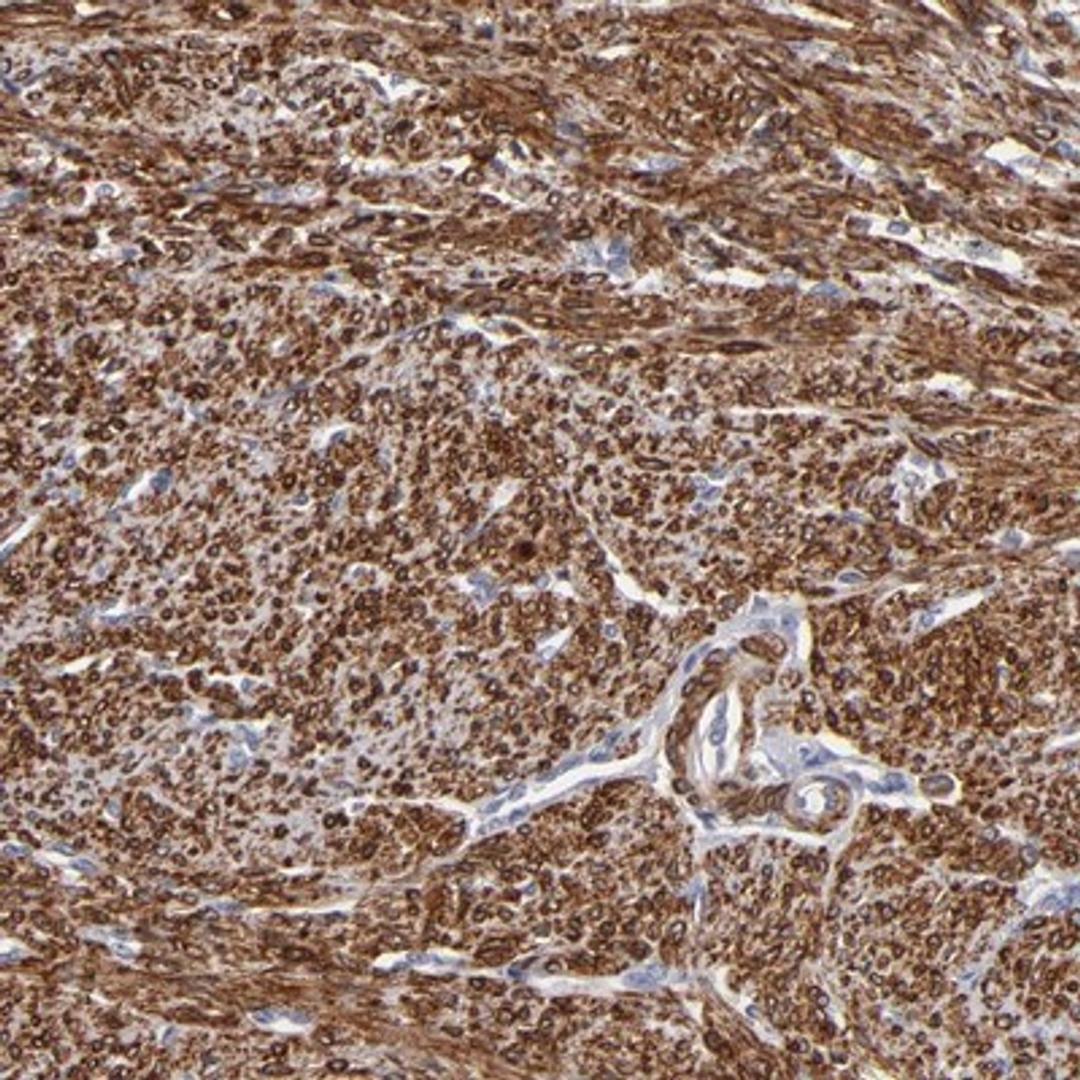 Immunohistochemistry-Paraffin: SLMAP Antibody [NBP1-81398] - Staining of human smooth muscle shows strong nuclear and cytoplasmic positivity in smooth muscle cells.