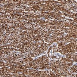 Immunohistochemistry-Paraffin: SLMAP Antibody [NBP1-81398] - Staining of human smooth muscle shows strong nuclear and cytoplasmic positivity in smooth muscle cells.