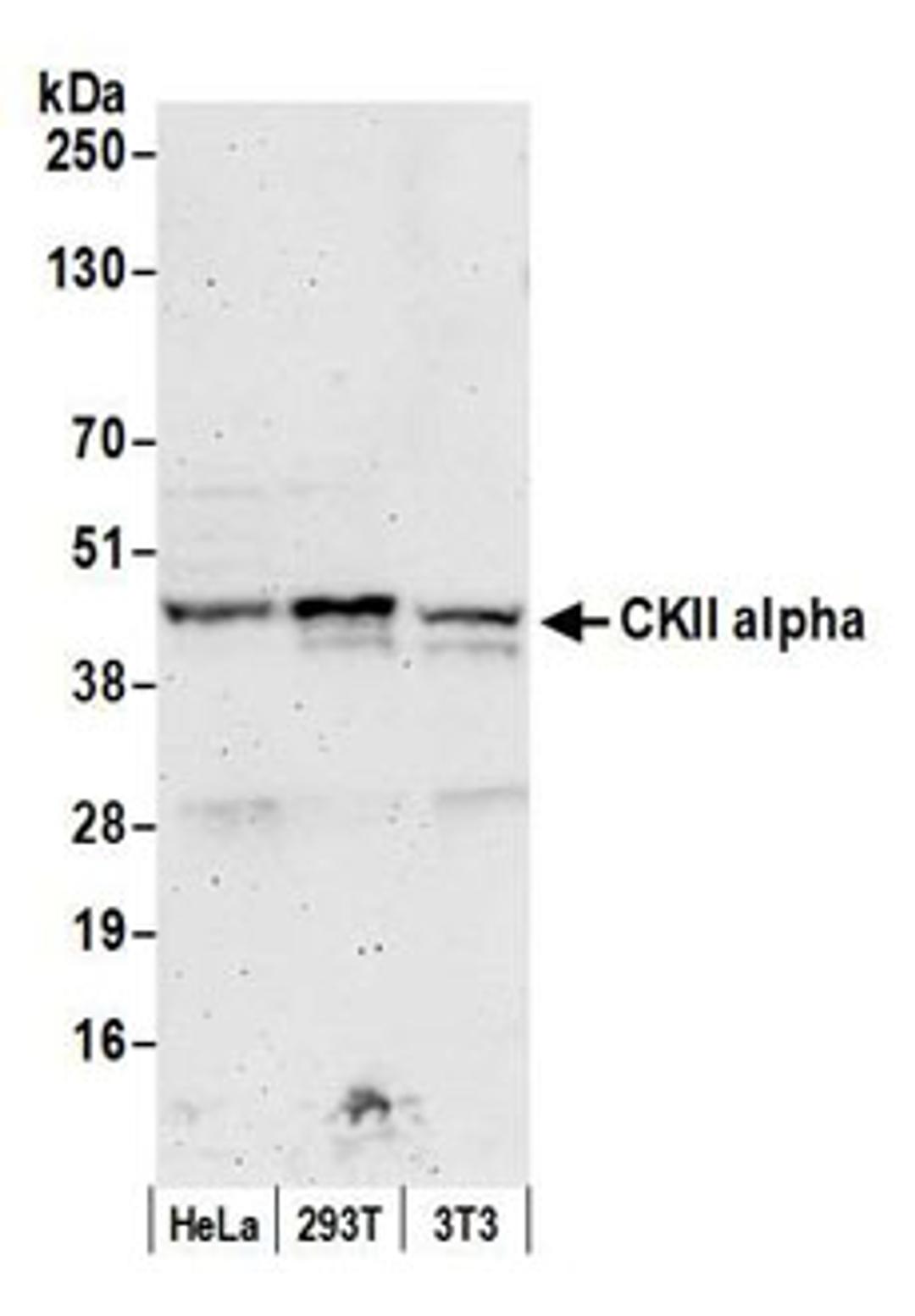 Detection of human and mouse CKII alpha by western blot.