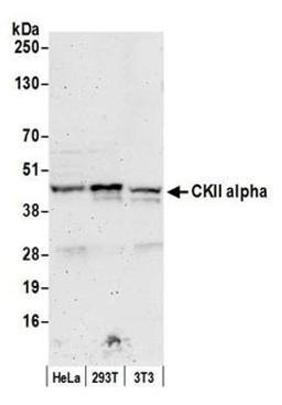 Detection of human and mouse CKII alpha by western blot.