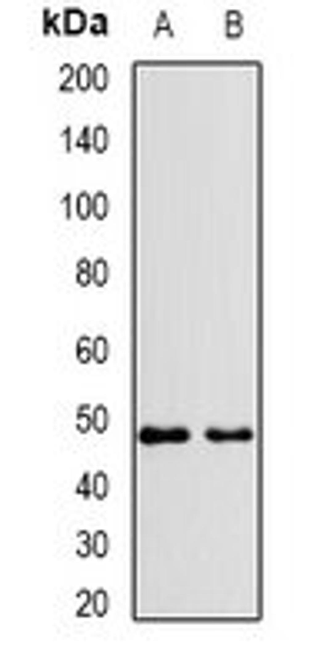 Western blot analysis of Jurkat (Lane1), HepG2 (Lane2) whole cell lysates using VPS37A antibody