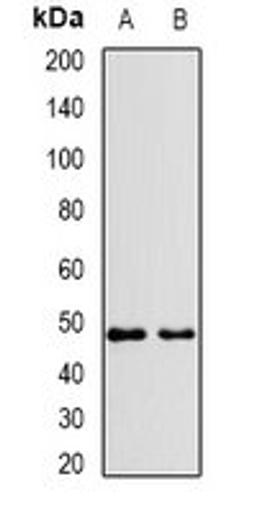 Western blot analysis of Jurkat (Lane1), HepG2 (Lane2) whole cell lysates using VPS37A antibody