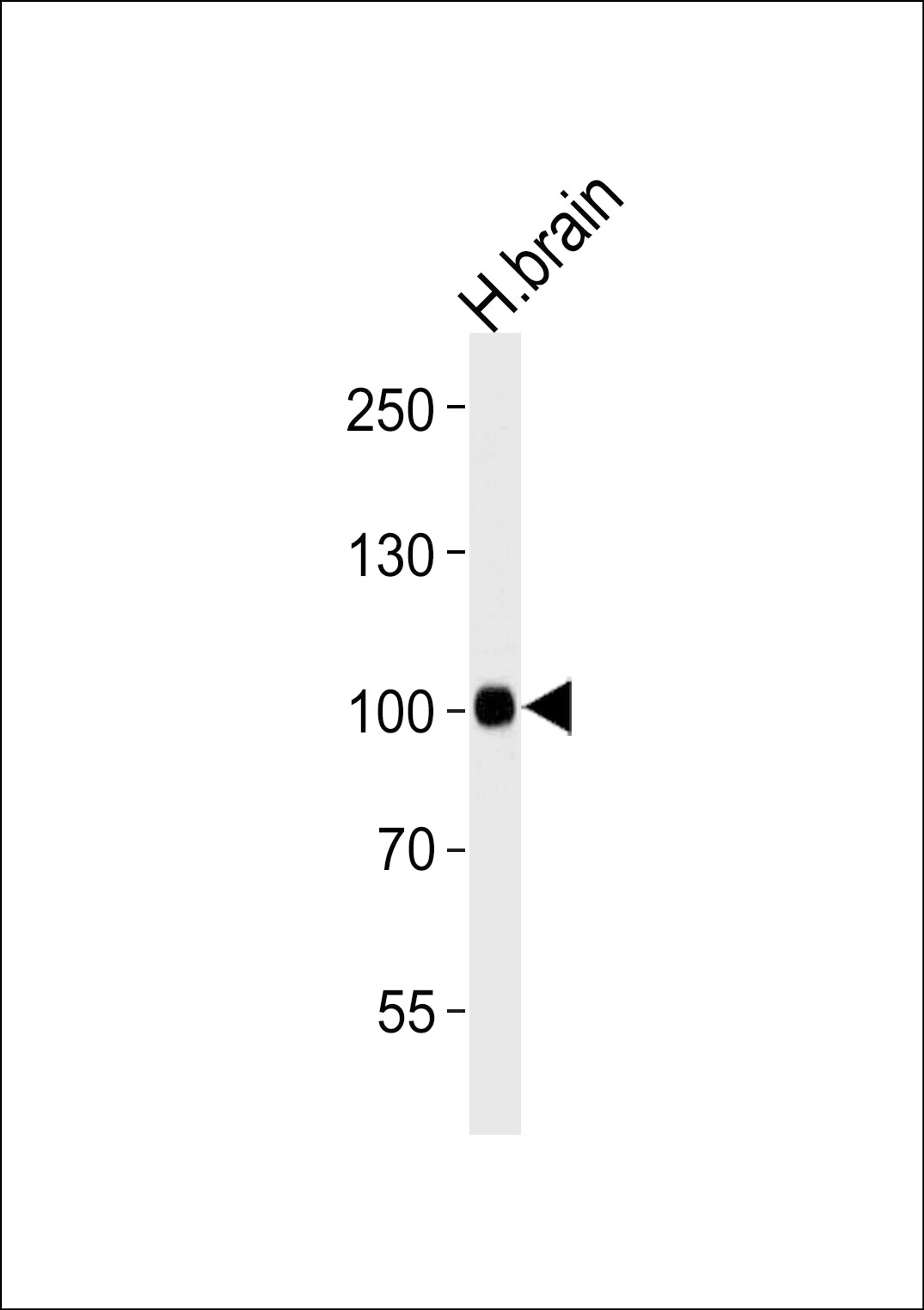 Western blot analysis of lysate from human brain tissue lysate, using CDH13 Antibody at 1:1000 at each lane.