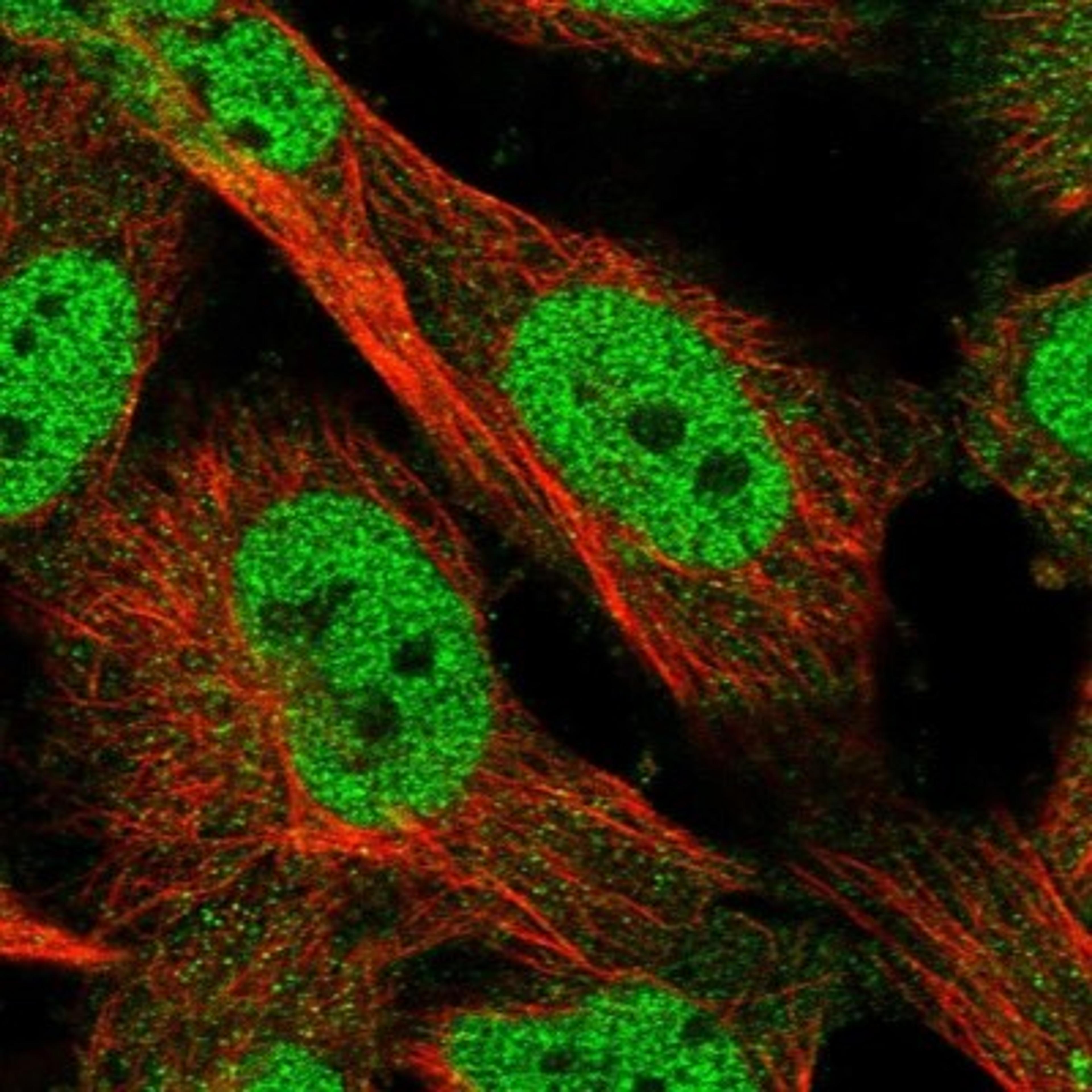 Immunocytochemistry/Immunofluorescence: KLHDC3 Antibody [NBP1-85196] - Staining of human cell line U-251MG shows positivity in nucleus but not nucleoli.