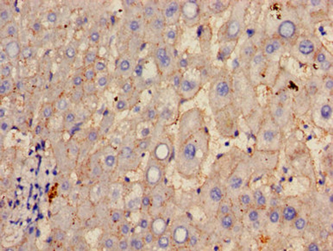 Immunohistochemistry of paraffin-embedded human liver tissue using CSB-PA10329A0Rb at dilution of 1:100