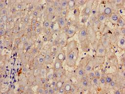 Immunohistochemistry of paraffin-embedded human liver tissue using CSB-PA10329A0Rb at dilution of 1:100