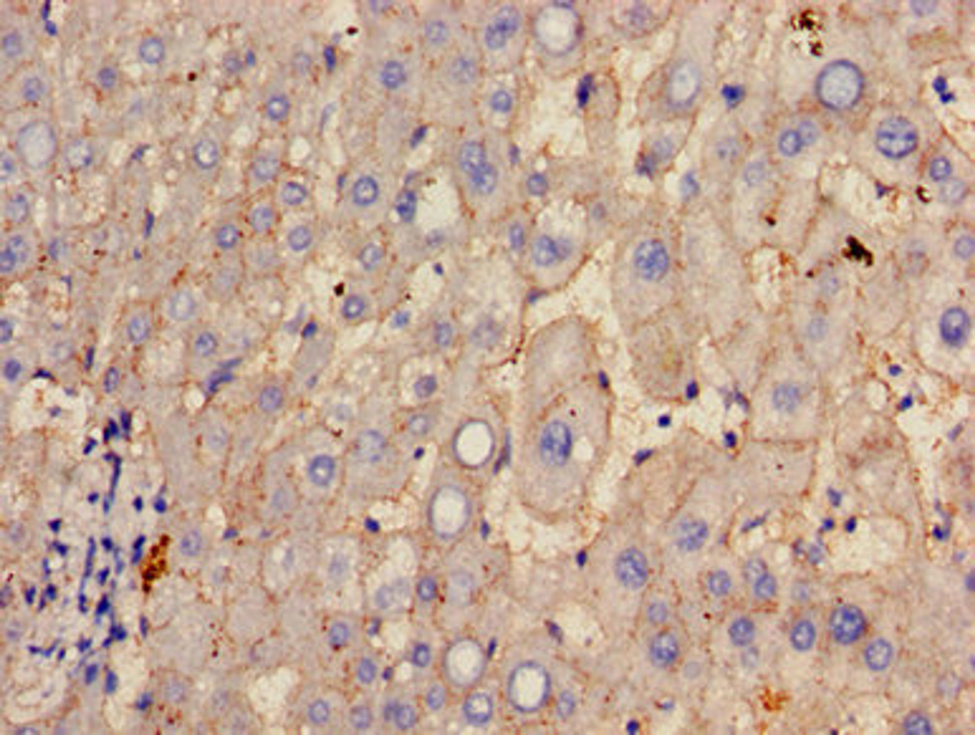 Immunohistochemistry of paraffin-embedded human liver tissue using CSB-PA10329A0Rb at dilution of 1:100