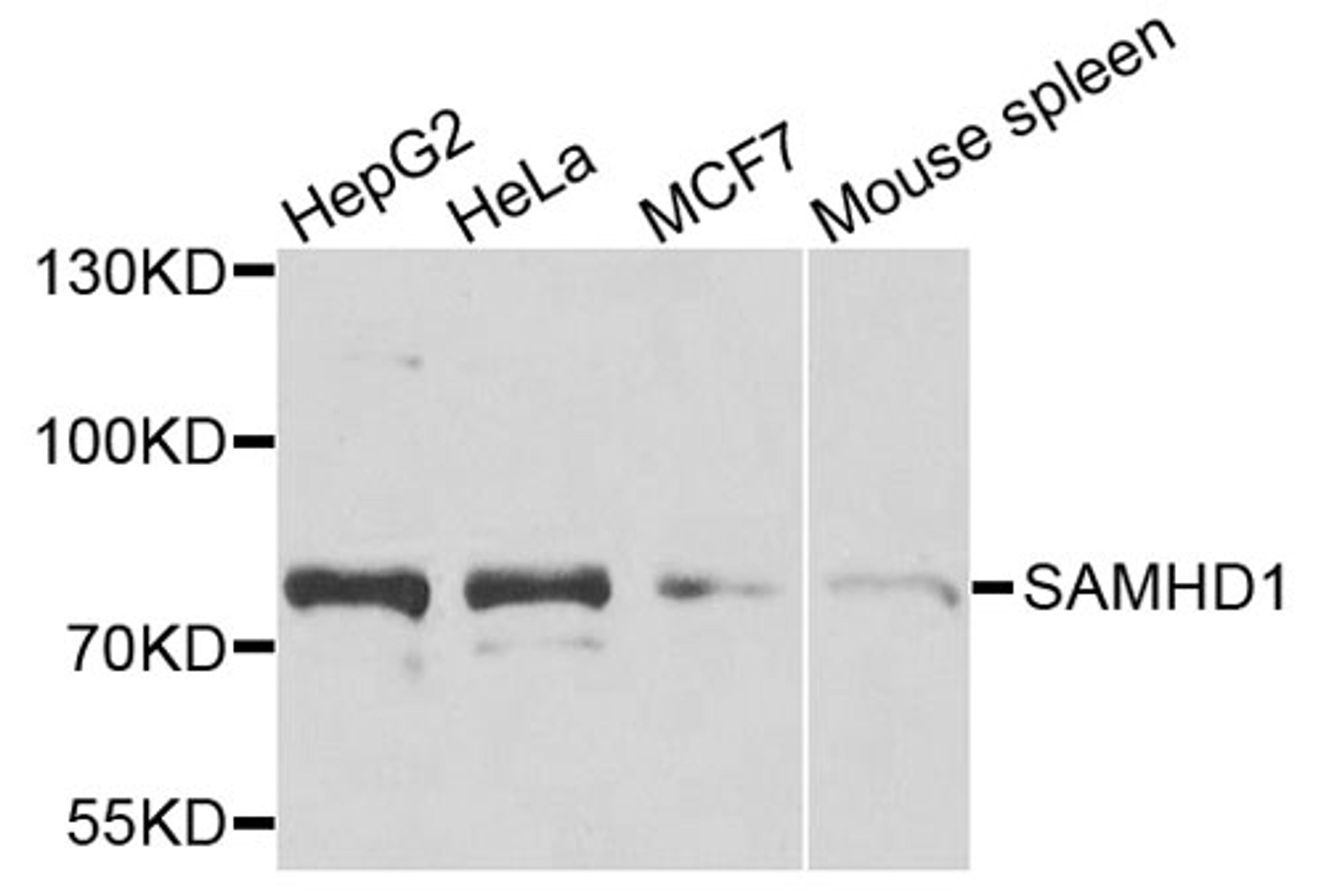 Western blot - SAMHD1 antibody (A7794)