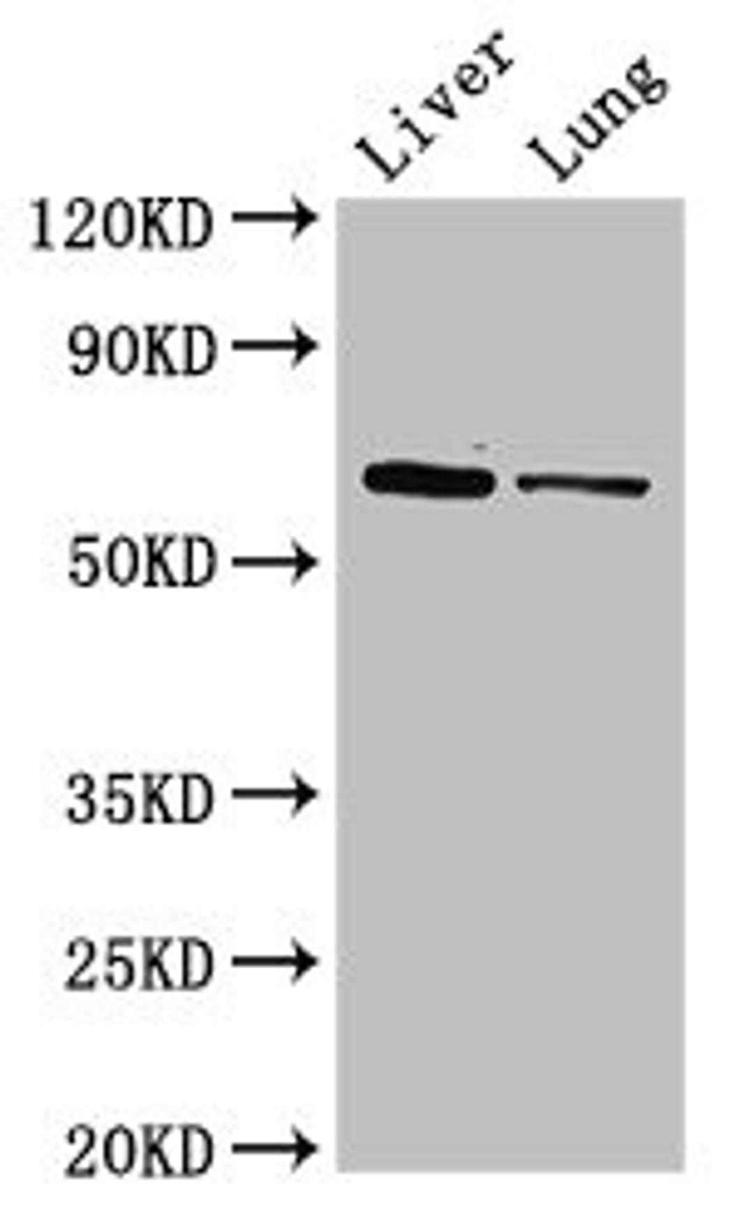 Western Blot. Positive WB detected in: Mouse liver tissue, Rat lung tissue. All lanes: Ces1c antibody at 5µg/ml. Secondary. Goat polyclonal to rabbit IgG at 1/50000 dilution. Predicted band size: 62 kDa. Observed band size: 62 kDa