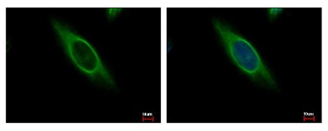 Immunocytochemistry/Immunofluorescence: CAB39 Antibody [NBP2-15658] - CAB39 antibody detects CAB39 protein at Cytoplasm by immunofluorescent analysis. Sample: HeLa cells were fixed in 4% paraformaldehyde at RT for 15 min. Green: CAB39 protein stained by CAB39 antibody diluted at 1:500. Blue: Hoechst 33343 staining.