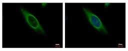 Immunocytochemistry/Immunofluorescence: CAB39 Antibody [NBP2-15658] - CAB39 antibody detects CAB39 protein at Cytoplasm by immunofluorescent analysis. Sample: HeLa cells were fixed in 4% paraformaldehyde at RT for 15 min. Green: CAB39 protein stained by CAB39 antibody diluted at 1:500. Blue: Hoechst 33343 staining.