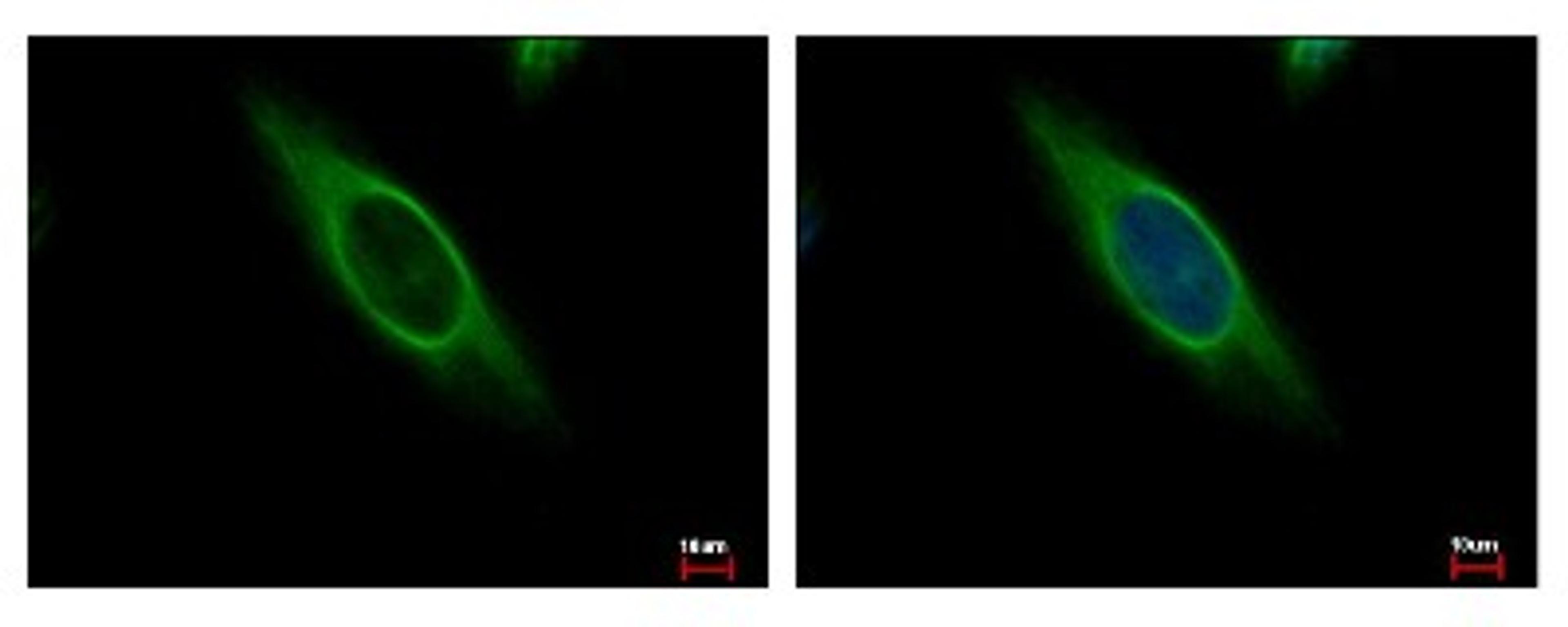 Immunocytochemistry/Immunofluorescence: CAB39 Antibody [NBP2-15658] - CAB39 antibody detects CAB39 protein at Cytoplasm by immunofluorescent analysis. Sample: HeLa cells were fixed in 4% paraformaldehyde at RT for 15 min. Green: CAB39 protein stained by CAB39 antibody diluted at 1:500. Blue: Hoechst 33343 staining.