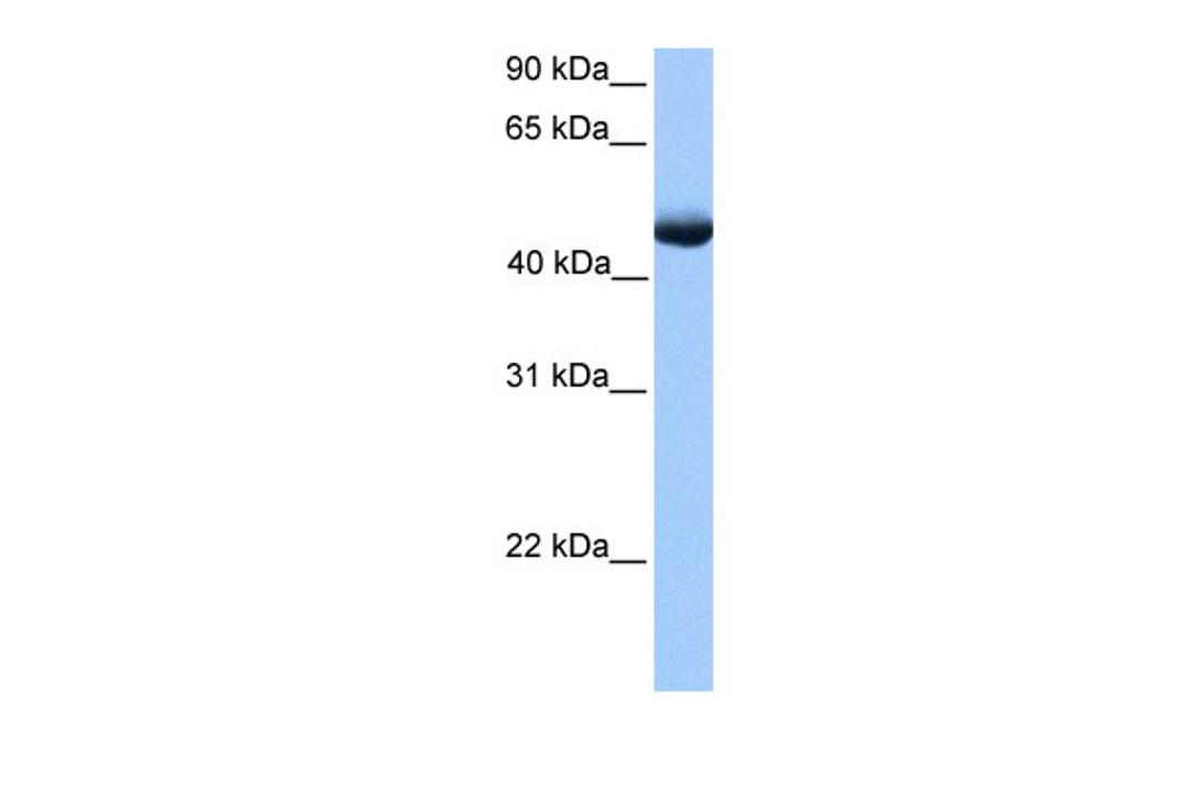 Antibody used in WB on Human Muscle at 0.2-1 ug/ml.