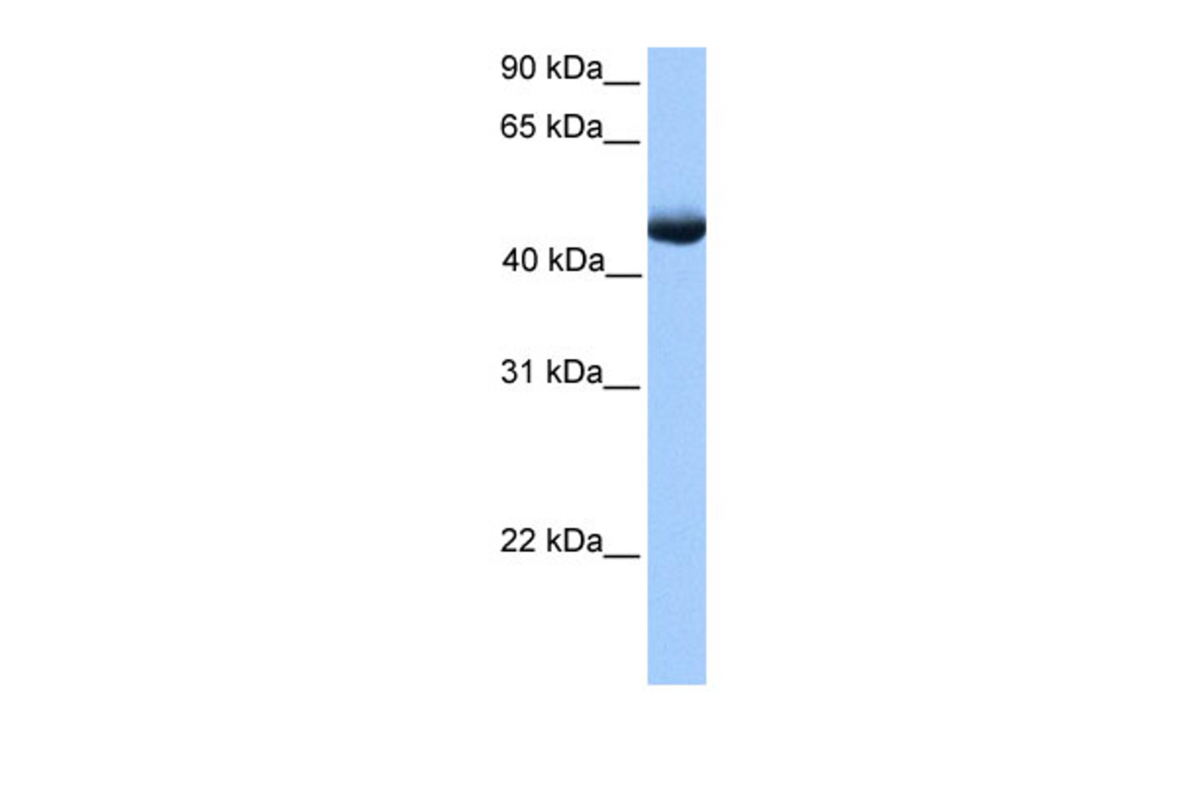 Antibody used in WB on Human Muscle at 0.2-1 ug/ml.