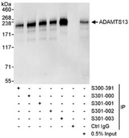 Detection of human ADAMTS13 by western blot and immunoprecipitation.