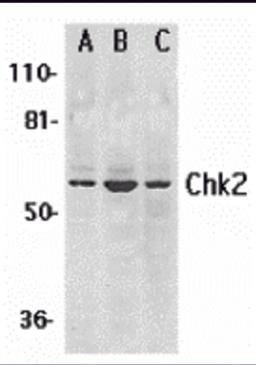 Western blot analysis of Chk2 expression in (A) K562, (B) Jurkat, and (C) HL-60 whole cell lysates with Chk2 antibody at 1 &#956;g /ml.