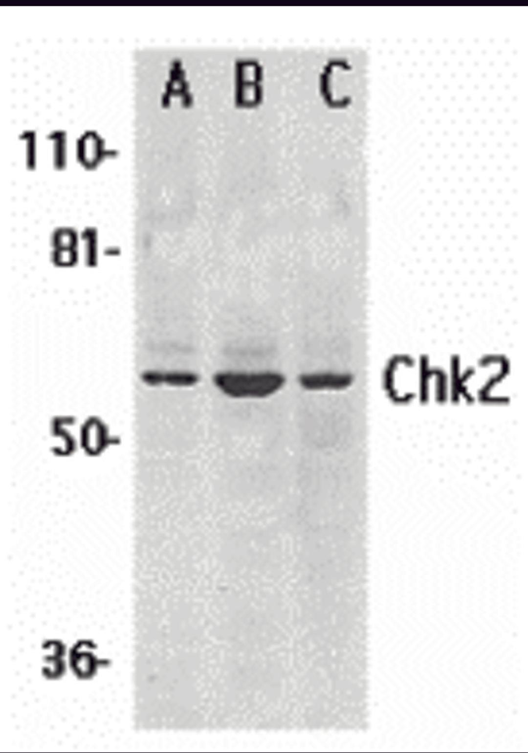 Western blot analysis of Chk2 expression in (A) K562, (B) Jurkat, and (C) HL-60 whole cell lysates with Chk2 antibody at 1 μg /ml.