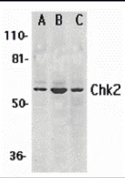 Western blot analysis of Chk2 expression in (A) K562, (B) Jurkat, and (C) HL-60 whole cell lysates with Chk2 antibody at 1 μg /ml.