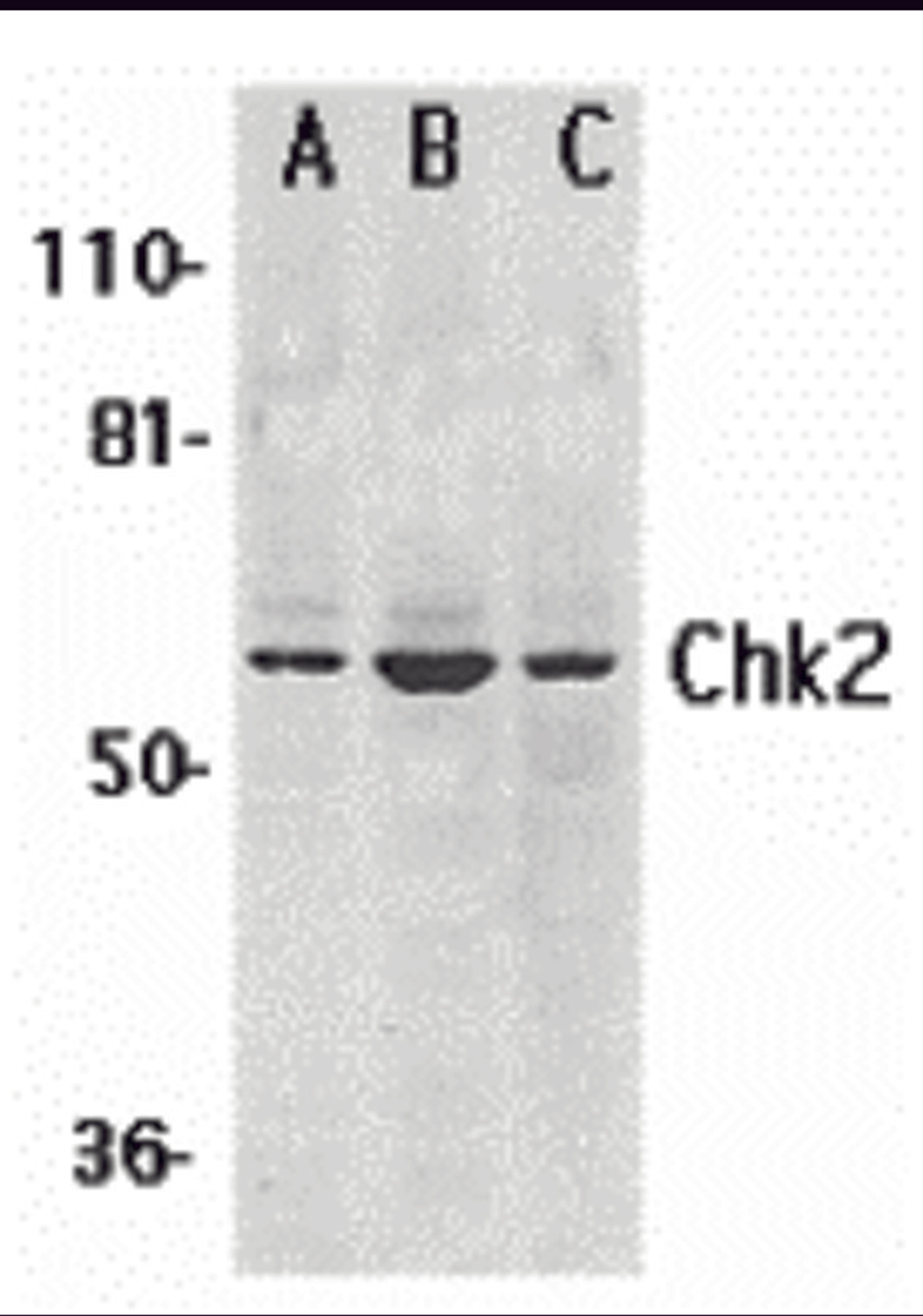 Western blot analysis of Chk2 expression in (A) K562, (B) Jurkat, and (C) HL-60 whole cell lysates with Chk2 antibody at 1 μg /ml.