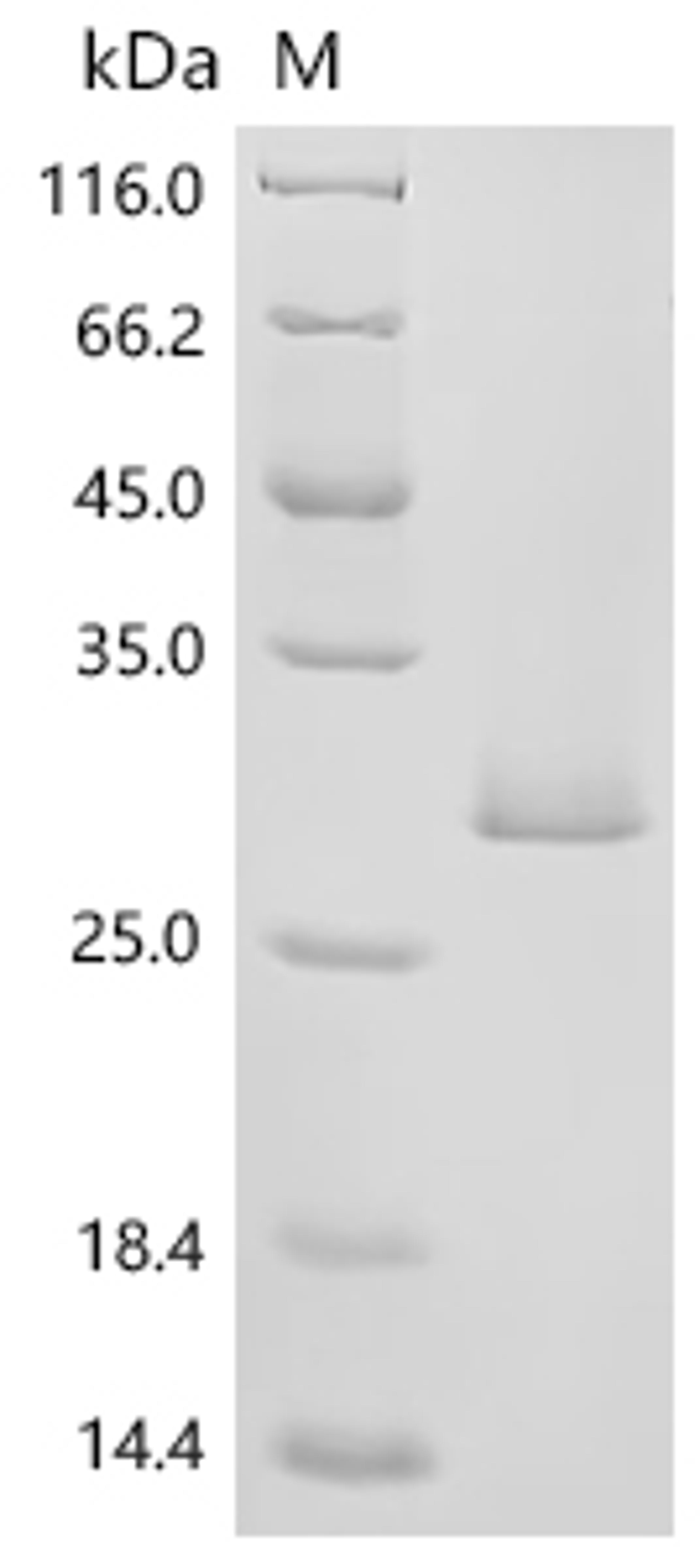 (Tris-Glycine gel) Discontinuous SDS-PAGE (reduced) with 5% enrichment gel and 15% separation gel.
