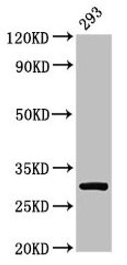 Western Blot. Positive WB detected in: 293 whole cell lysate. All lanes: RPA2 antibody at 2µg/ml. Secondary. Goat polyclonal to rabbit IgG at 1/50000 dilution. Predicted band size: 30, 31, 39 kDa. Observed band size: 30 kDa