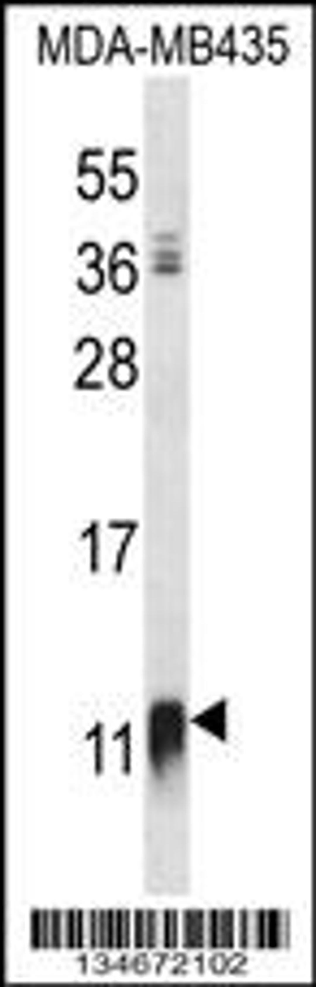 Western blot analysis in MDA-MB435 cell line lysates (35ug/lane).