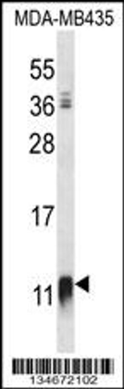 Western blot analysis in MDA-MB435 cell line lysates (35ug/lane).