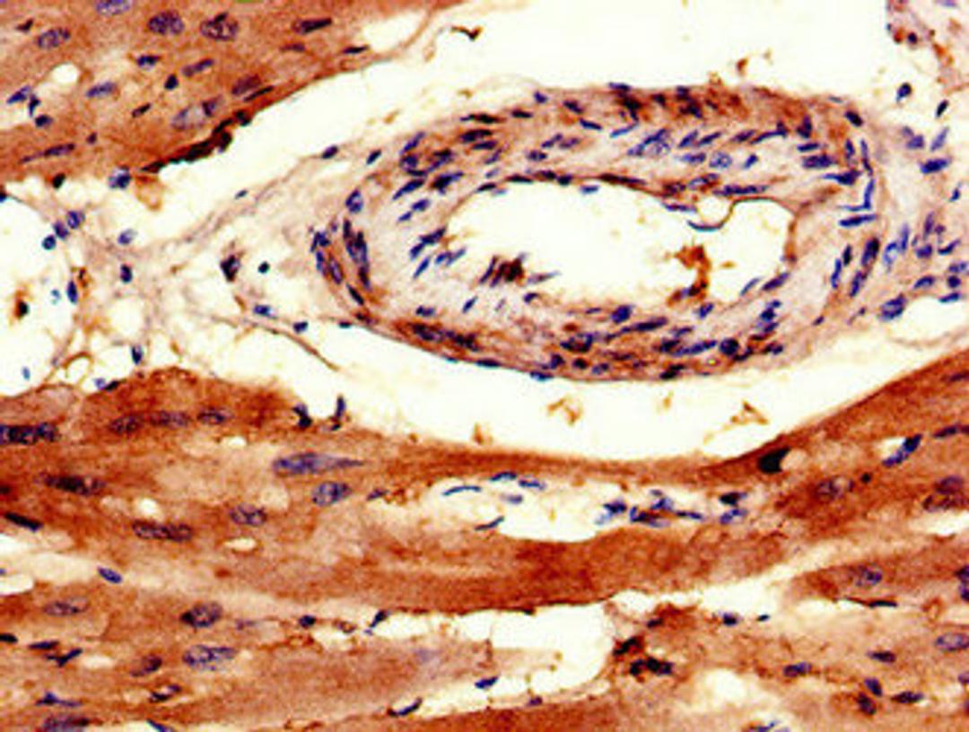 Immunohistochemistry of paraffin-embedded human heart tissue using CSB-PA842741LA01HU at dilution of 1:100