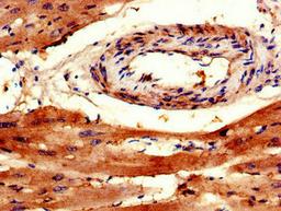 Immunohistochemistry of paraffin-embedded human heart tissue using CSB-PA842741LA01HU at dilution of 1:100