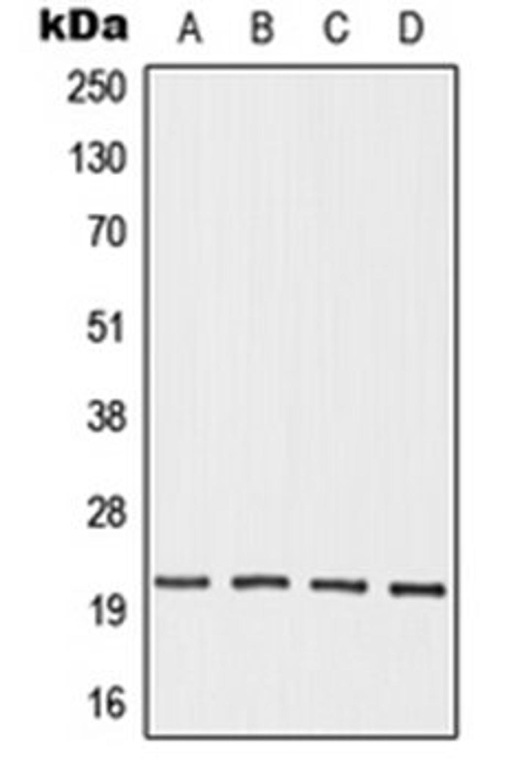 Western blot analysis of HEK293T (Lane 1), Jurkat (Lane 2), mouse testis (Lane 3), rat testis (Lane 4) whole cell lysates using OAZ3 antibody