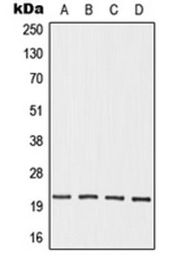 Western blot analysis of HEK293T (Lane 1), Jurkat (Lane 2), mouse testis (Lane 3), rat testis (Lane 4) whole cell lysates using OAZ3 antibody