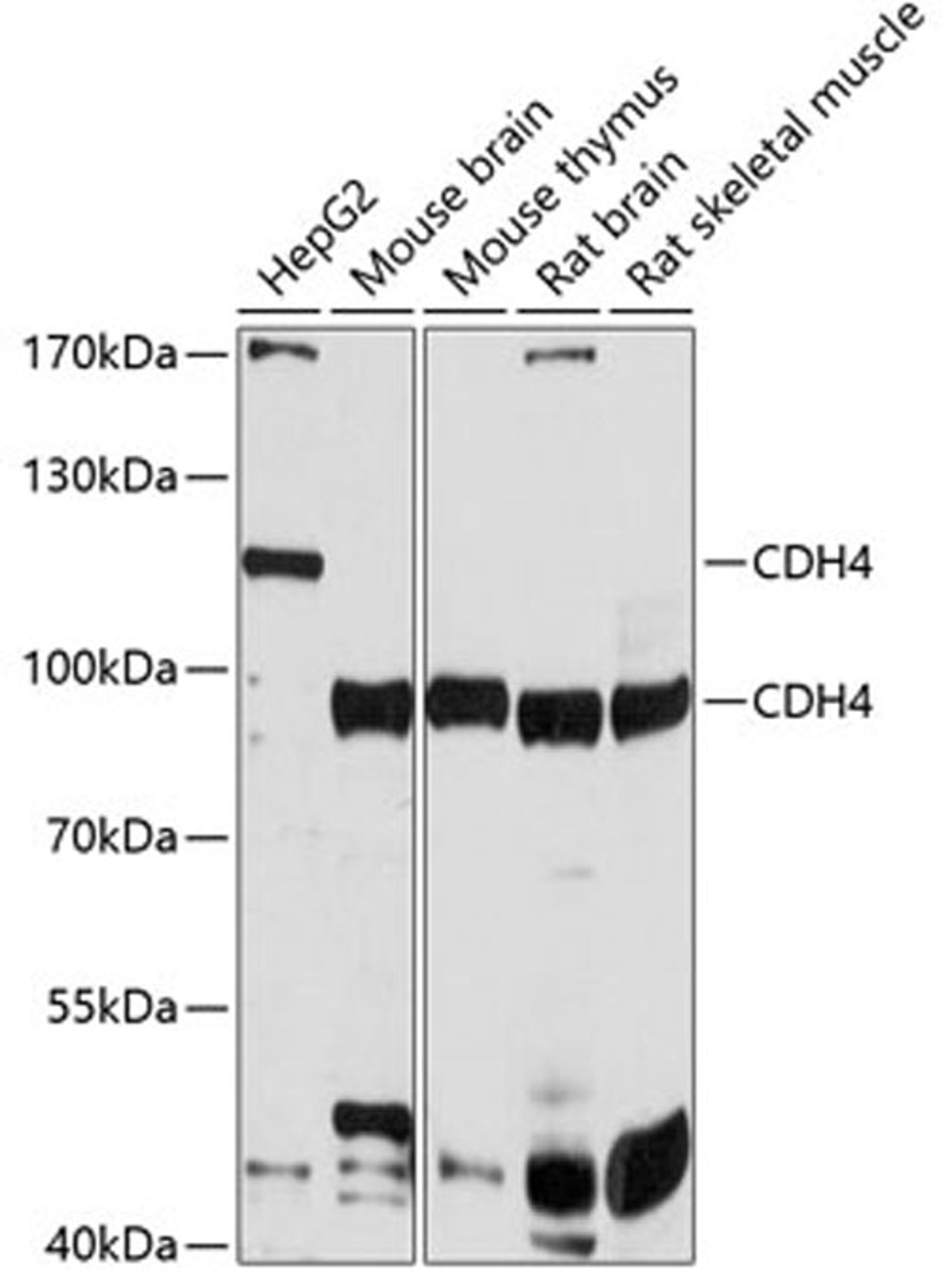 Western blot - CDH4 antibody (A10557)