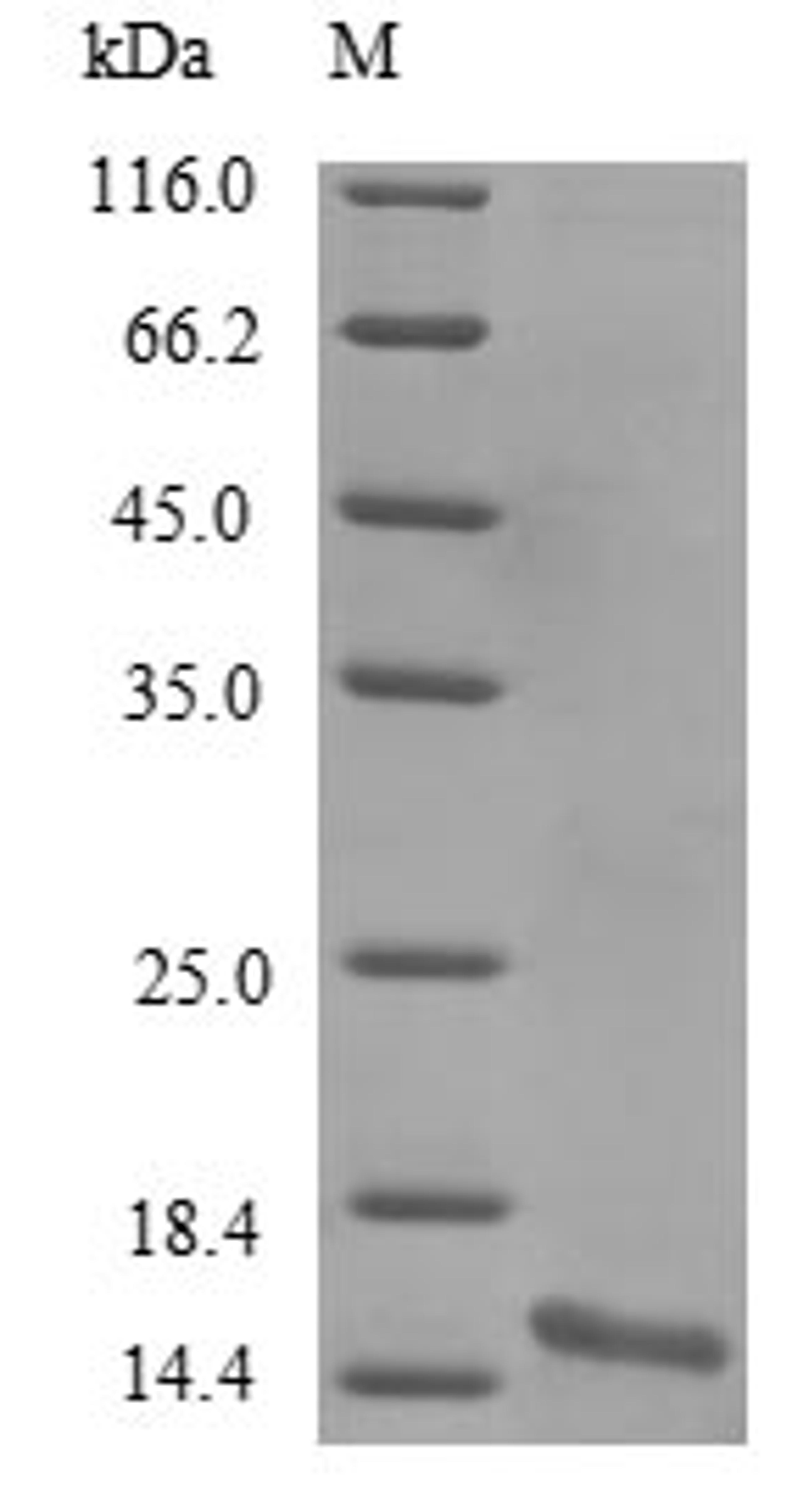 (Tris-Glycine gel) Discontinuous SDS-PAGE (reduced) with 5% enrichment gel and 15% separation gel.