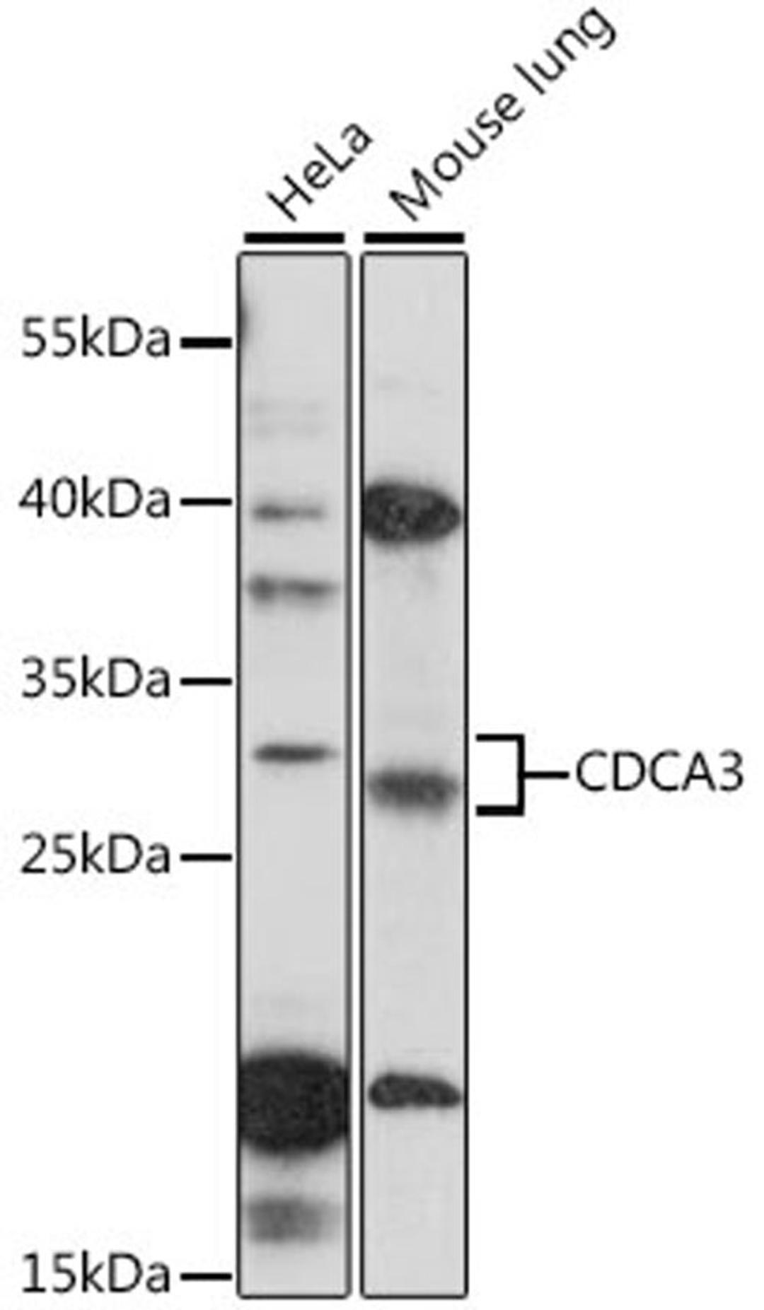 Western blot - CDCA3 antibody (A16151)