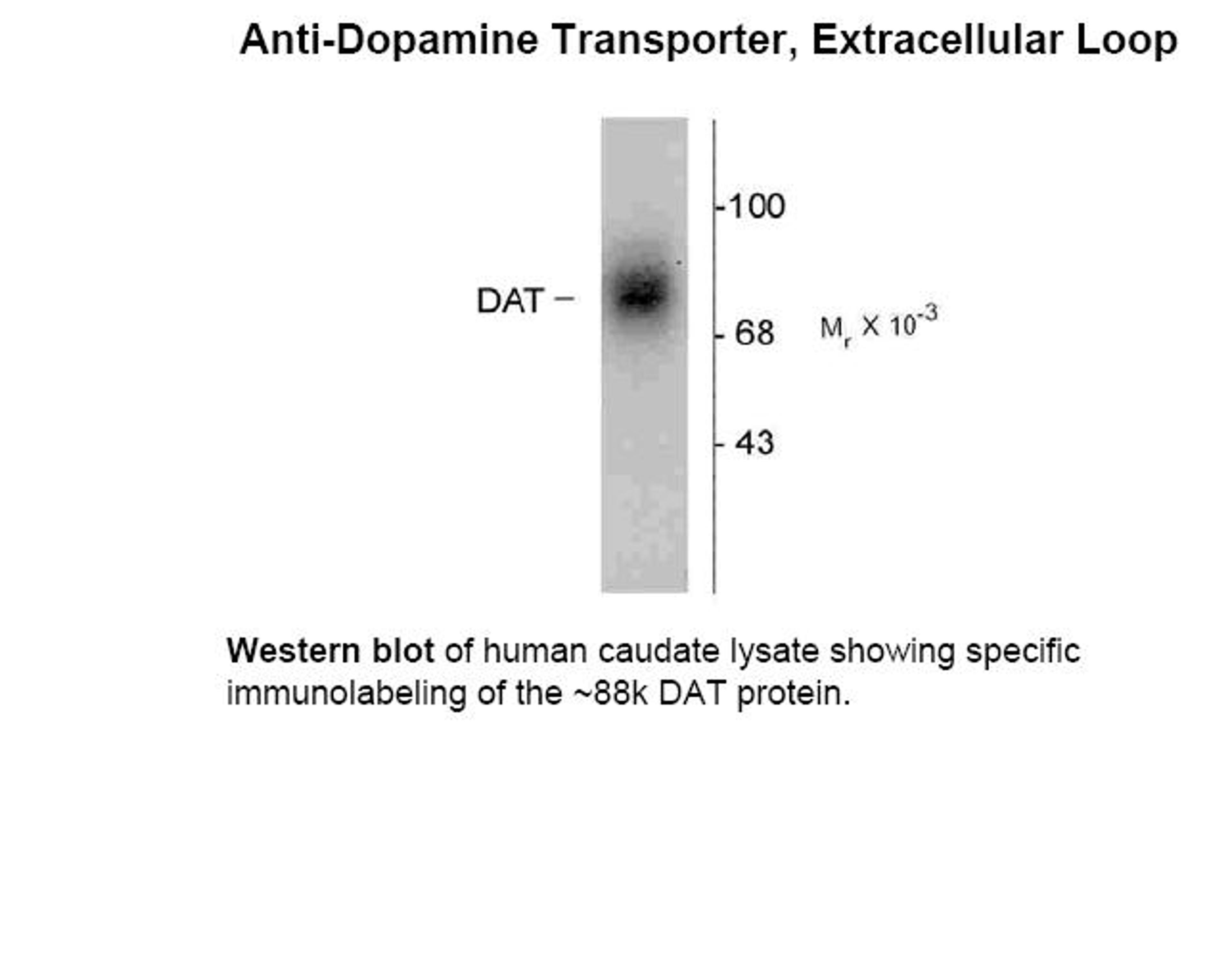 Western blot of human caudate lysate showing specific immunolabeling of the ~88k DAT protein.