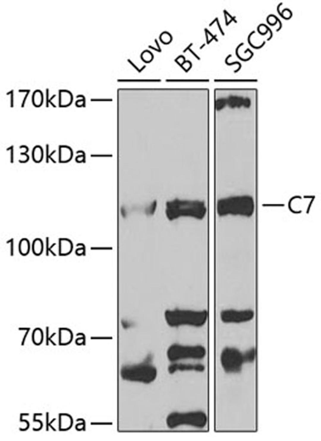 Western blot - C7 antibody (A5394)