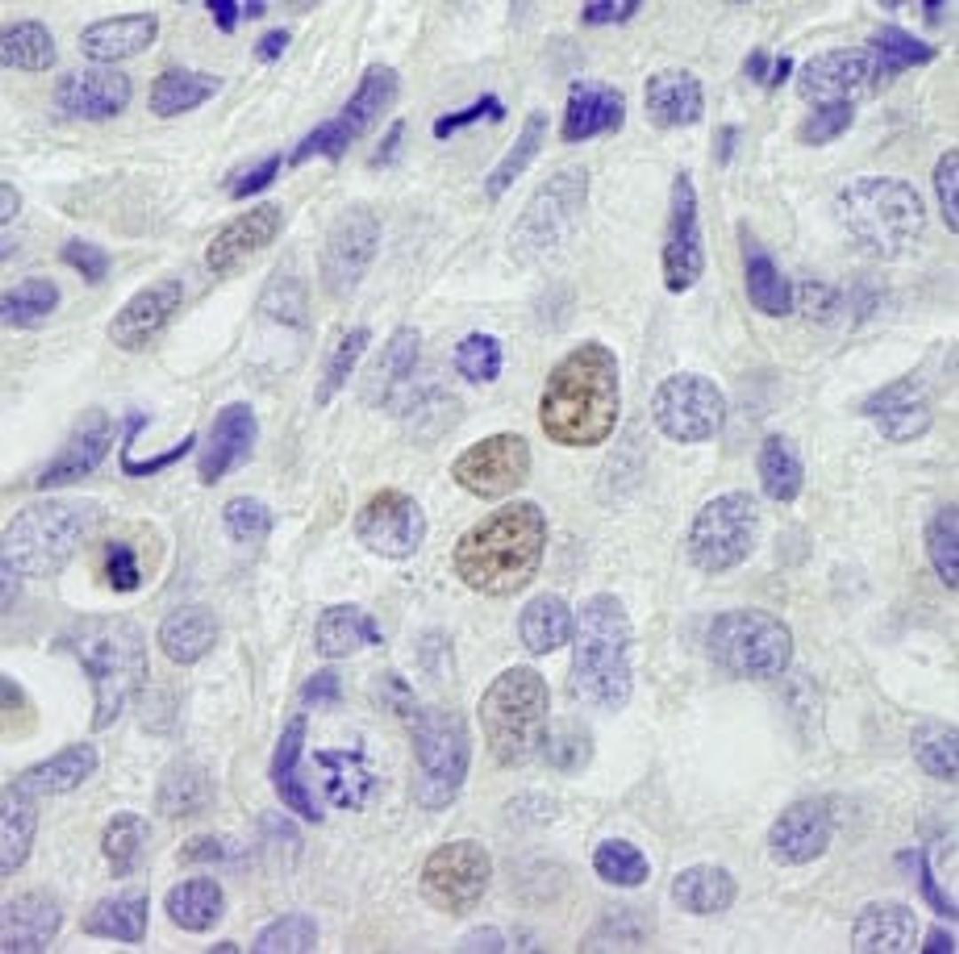 Detection of human INT11 by immunohistochemistry.