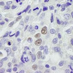 Detection of human INT11 by immunohistochemistry.