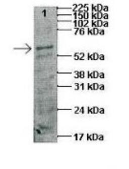 Western Blot: CTP synthase Antibody [NBP1-52892] - Lanes: 1 : 45ug human capan1 cell lysate Primary, Antibody Dilution: 1 : 1000 Secondary Antibody: Anti-rabbit HRP Secondary, Antibody Dilution: 1 : 5000 Gene name: CTPS.