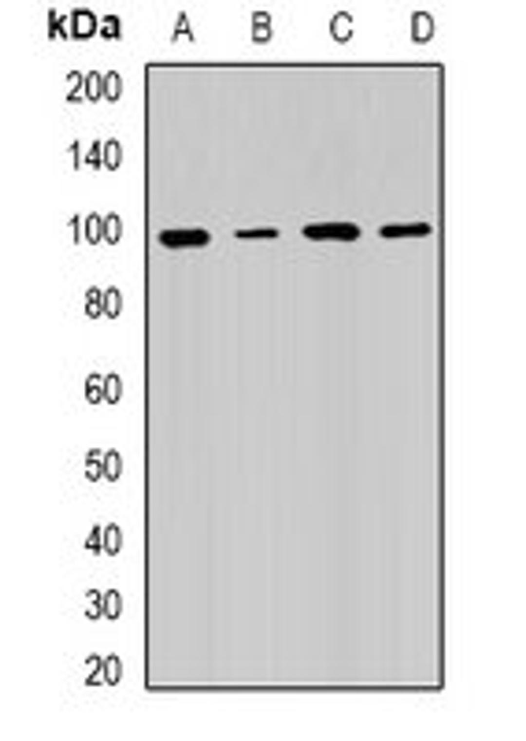 Western blot analysis of Hela (Lane1), SW480 (Lane2), mouse testis (Lane3), mouse spleen (Lane4) whole cell lysates using RRM1 antibody