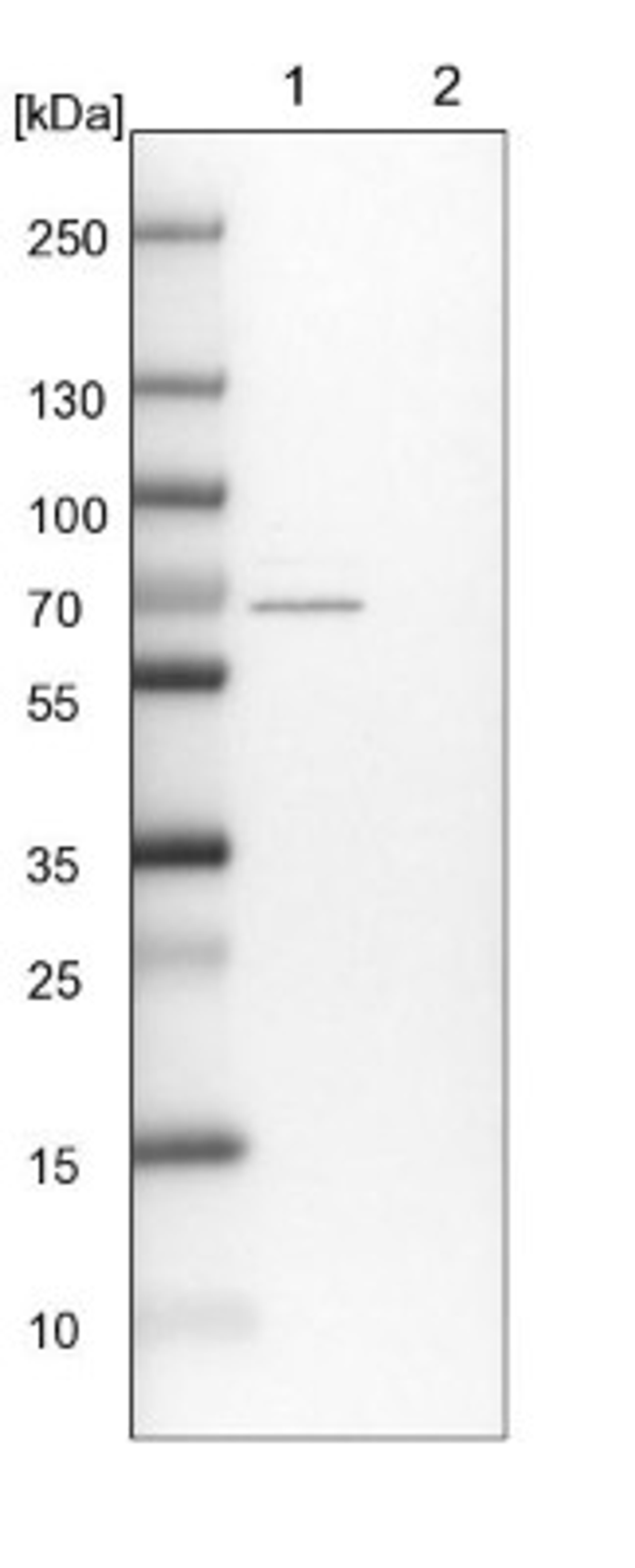 Western Blot: TMPRSS7 Antibody [NBP1-90893] - Lane 1: NIH-3T3 cell lysate (Mouse embryonic fibroblast cells)<br/>Lane 2: NBT-II cell lysate (Rat Wistar bladder tumour cells)