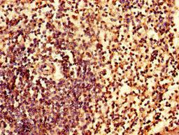Immunohistochemistry of paraffin-embedded human spleen tissue using CSB-PA011822LA01HU at dilution of 1:100