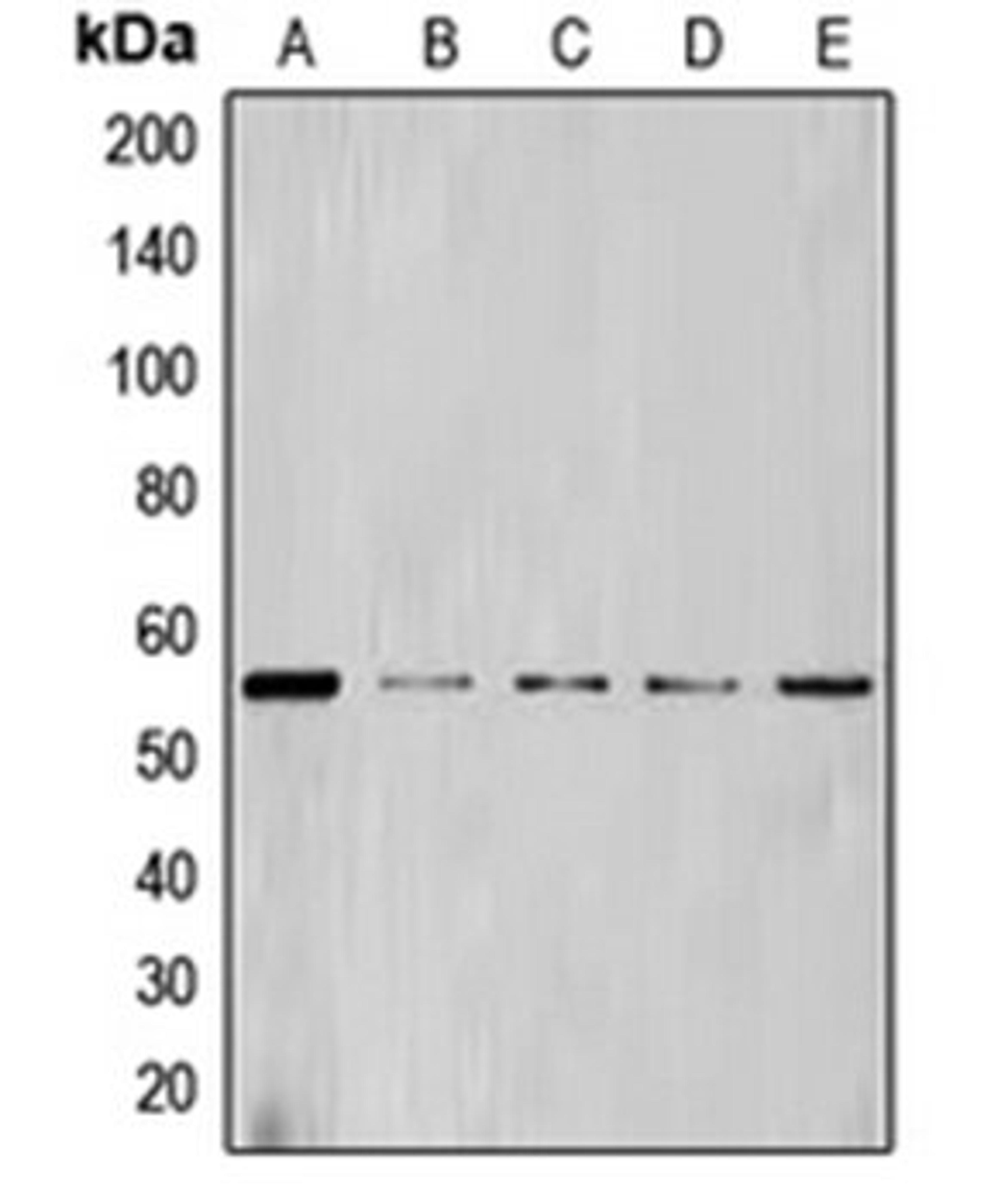 Western blot analysis of HL60 (Lane 1), NIH3T3 (Lane 2), Jurkat (Lane 3), THP1 (Lane 4), K562 (Lane 5) whole cell lysates using CCNL1 antibody