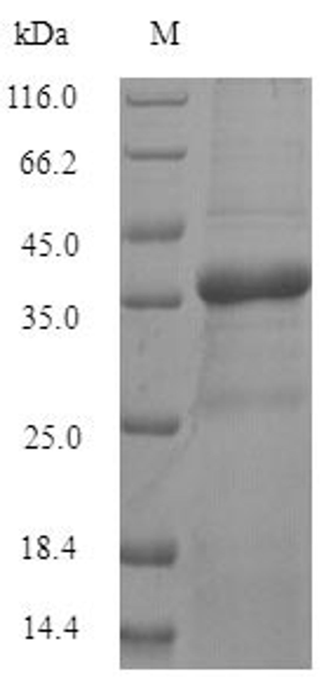 (Tris-Glycine gel) Discontinuous SDS-PAGE (reduced) with 5% enrichment gel and 15% separation gel.