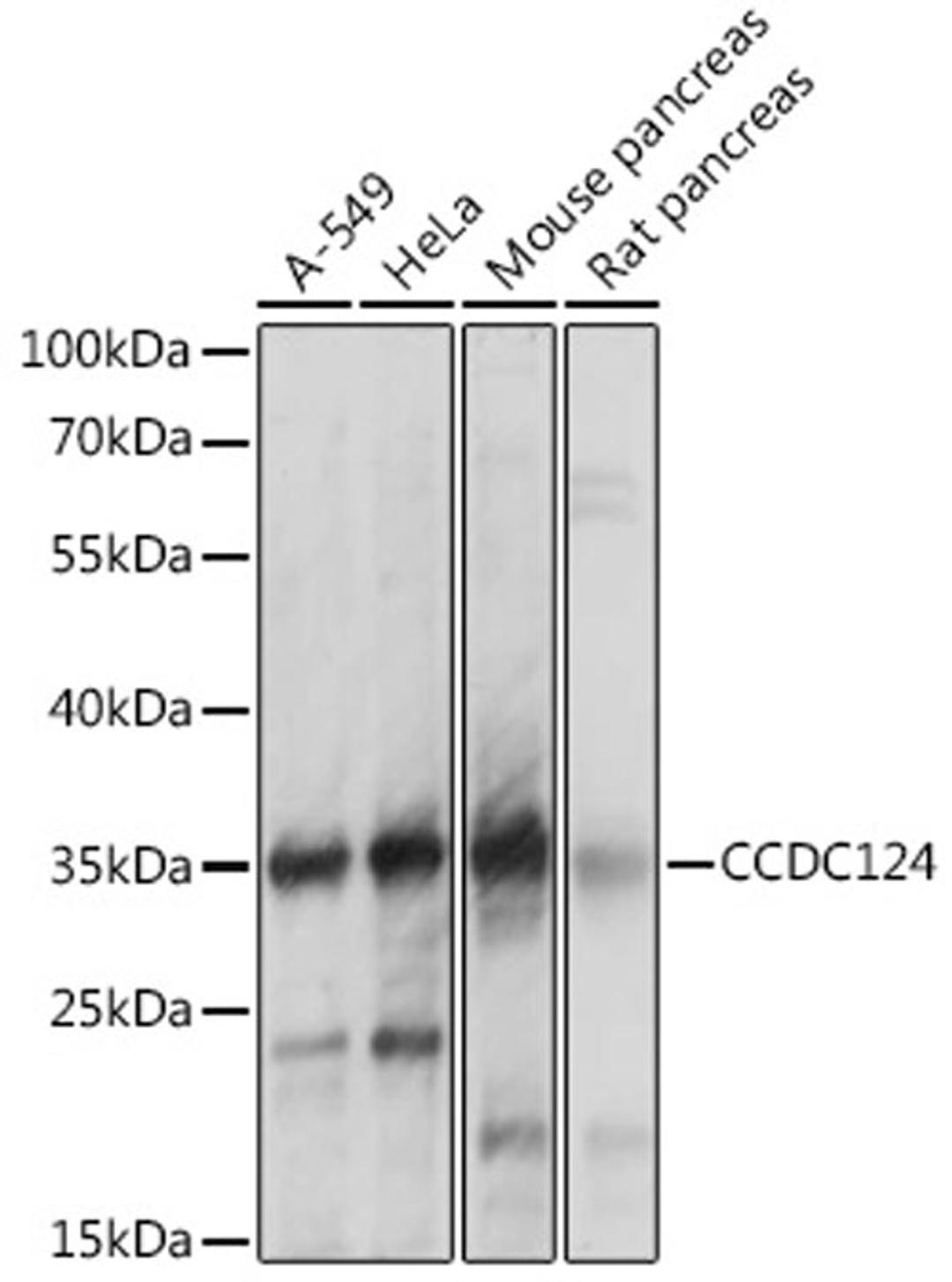 Western blot - CCDC124 antibody (A14298)