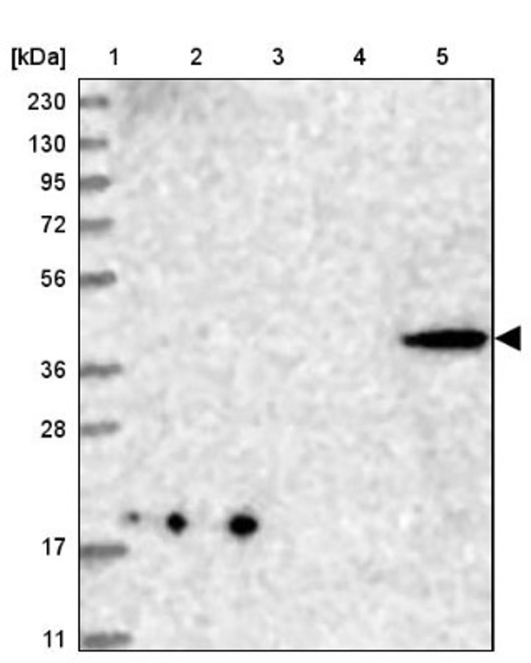 Western Blot: CNTLN Antibody [NBP1-88795] - Lane 1: Marker [kDa] 230, 130, 95, 72, 56, 36, 28, 17, 11<br/>Lane 2: Human cell line RT-4<br/>Lane 3: Human cell line U-251MG sp<br/>Lane 4: Human plasma (IgG/HSA depleted)<br/>Lane 5: Human liver tissue