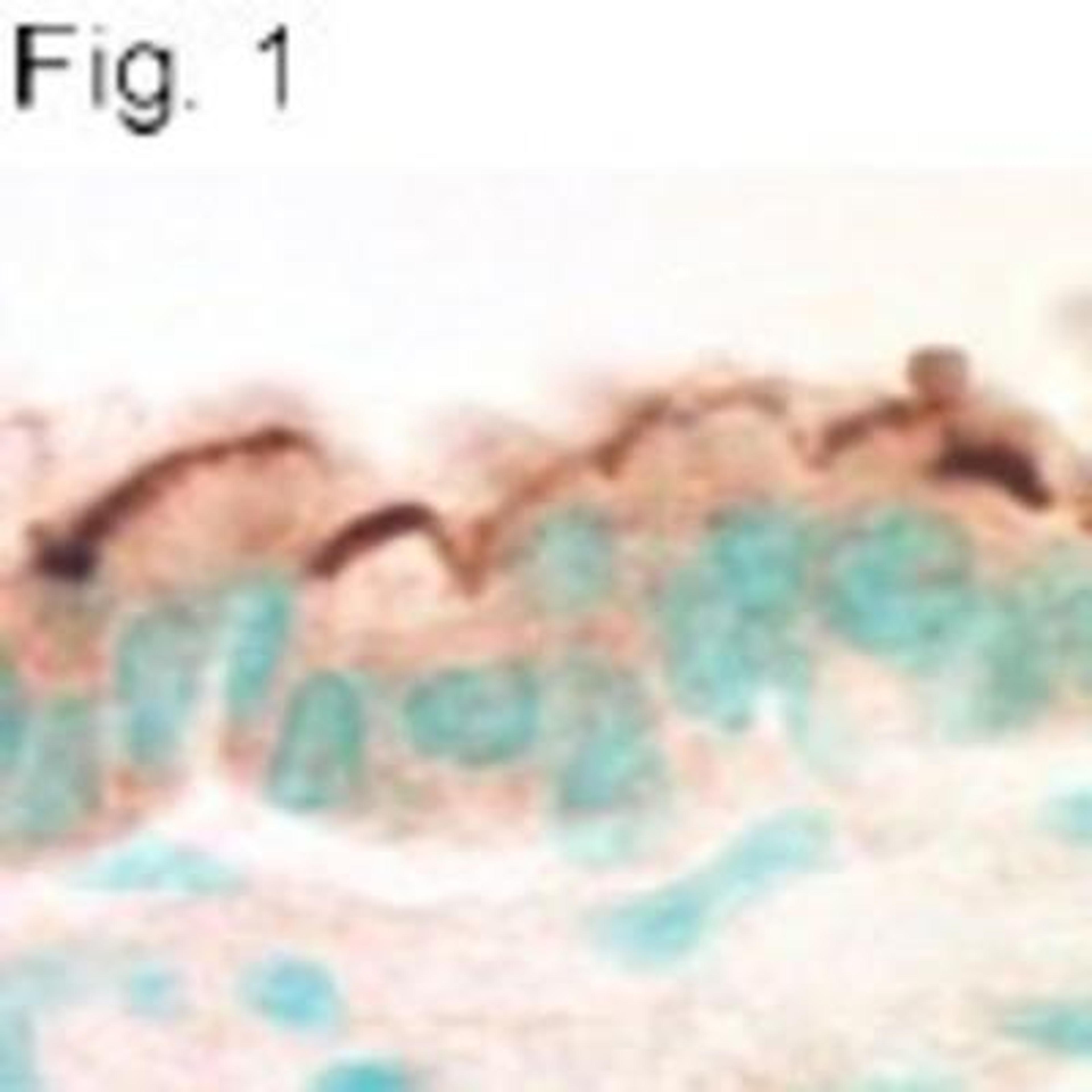 Immunohistochemistry: NHERF-1 Antibody [NB300-536] - Analysis of mouse airway.