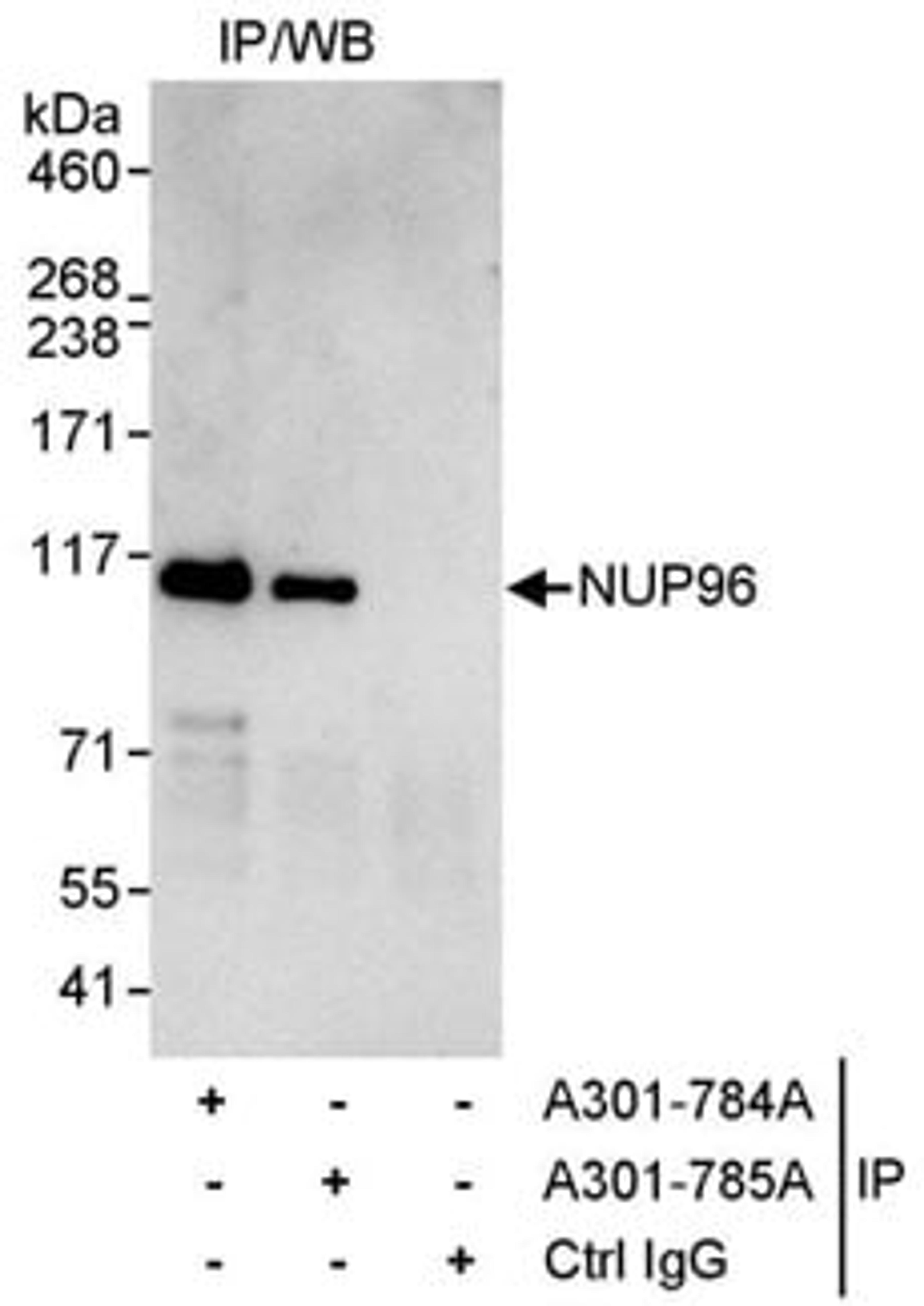 Detection of human NUP96 by western blot of immunoprecipitates.